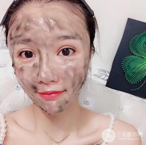 辣媽做了自體脂肪填充全臉，對(duì)比圖分享