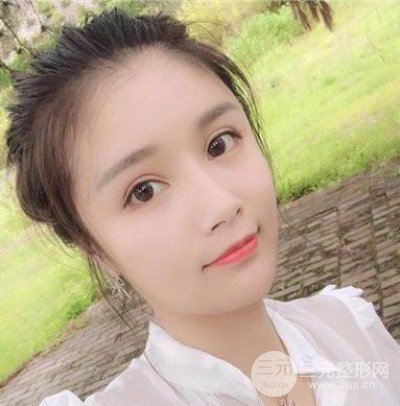 辣媽做了自體脂肪填充全臉，對(duì)比圖分享