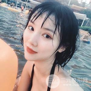 全切雙眼皮半個月恢復全記錄