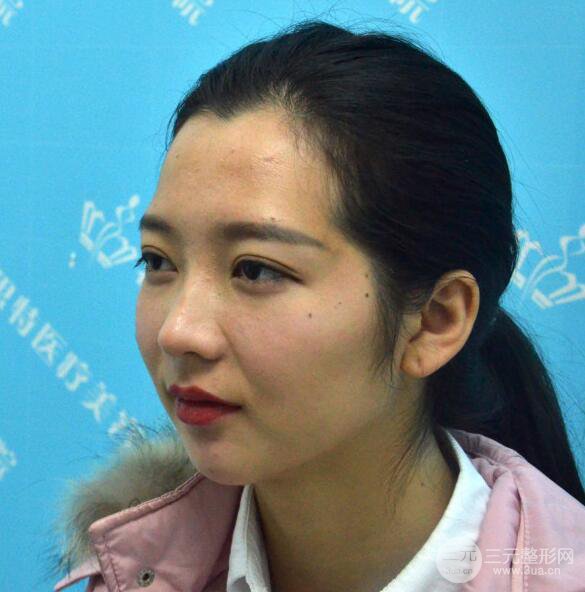 長得太著急是怎樣一種體驗？妹子血淚分享自體脂肪填充詳細部年輕化經(jīng)驗
