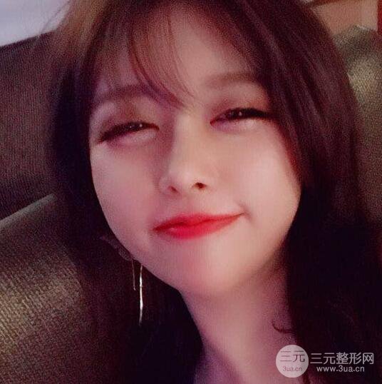 減肥太辛苦了，我還是做個面部吸脂來逆襲