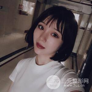 全切雙眼皮半個月恢復全記錄