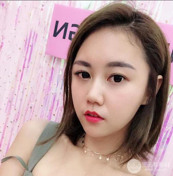泉州億星閔英俊磨骨恢復圖分享
