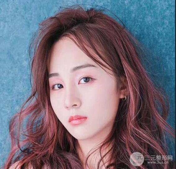 洛陽愛尚醫(yī)療美容王廷金隆鼻整形果圖，恢復(fù)后有點像張鈞甯