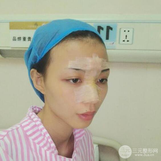 銀川崔大夫博士麗朱杰硅膠隆鼻恢復圖，輕松get精致臉