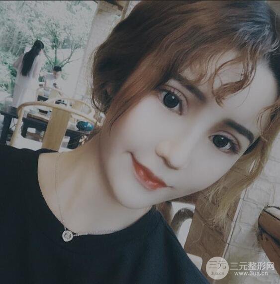 原來(lái)我和baby的距離只差一個(gè)網(wǎng)紅套餐，“雙眼皮+自體脂肪填充+豐唇”術(shù)后真人反饋