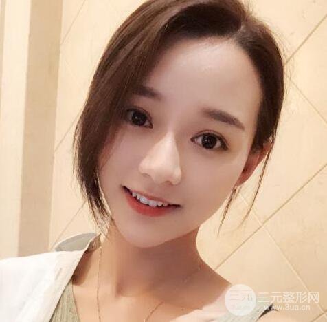 自體脂肪全臉填充三個(gè)月恢復(fù)圖，真實(shí)案例分享
