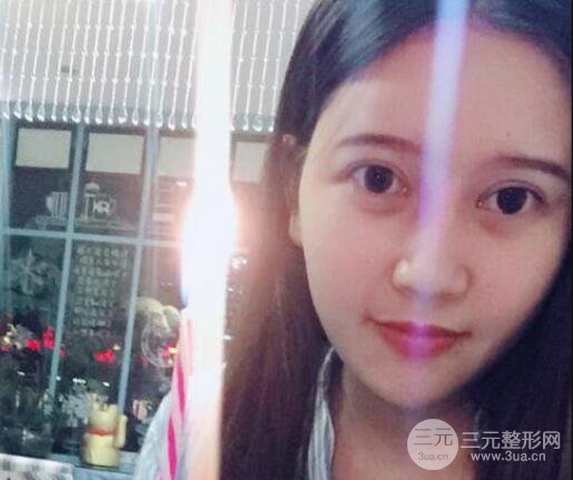 宜昌美岸醫(yī)療美容李英華自體脂肪面部填充怎么樣？真人日記曝光