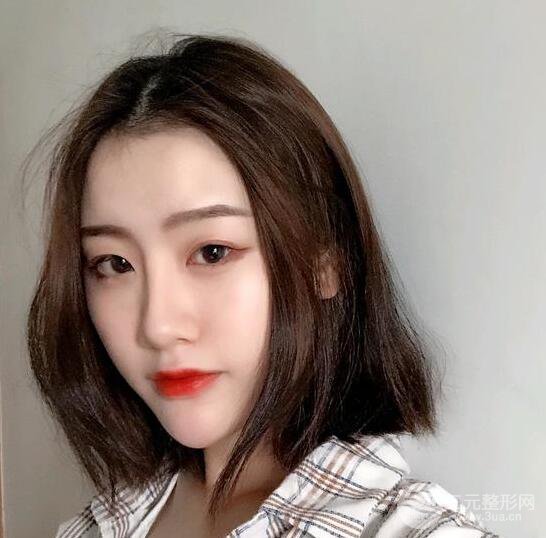 膨體隆鼻三十天恢復(fù)記錄，術(shù)前術(shù)后對比圖片曝光