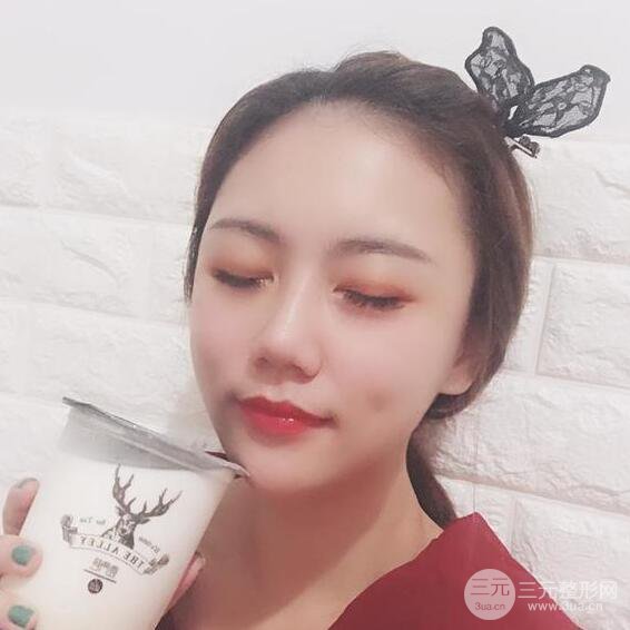 泉州億星閔英俊磨骨恢復圖分享
