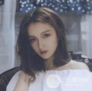 隆鼻整形多久恢復(fù)自然，模特公布隆鼻整形恢復(fù)記錄附照片