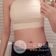 自體脂肪隆胸恢復(fù)圖曝光，見證從A到C的蛻變