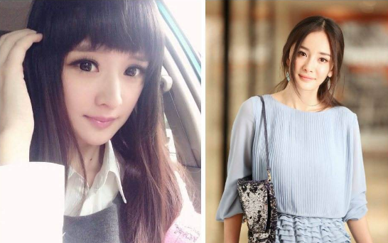 眼睛整形手術(shù)，陳丹婷整容前舊照曝光