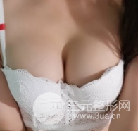 自體脂肪隆胸恢復(fù)圖曝光，見證從A到C的蛻變