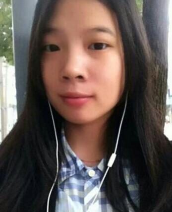 八大處靳小雷埋線雙眼皮一個多月了，果很好哦~~~