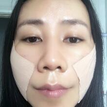 面b提升手術價格和真人案例