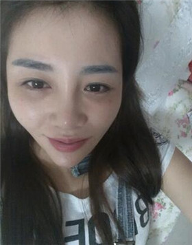 來(lái)評(píng)價(jià)一下華美劉琦做的高強(qiáng)度聚焦超聲吧