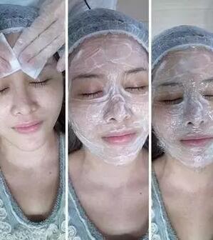 成都玉之光激光嫩膚經(jīng)歷 愛美的MM一定要看