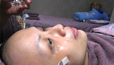 成都玉之光做了杏仁酸換膚 皮膚真的凈白無瑕了