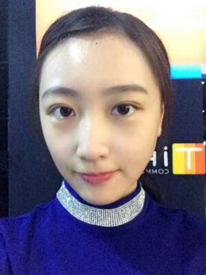 何賢清全切雙眼皮加去脂肪 果賊自然