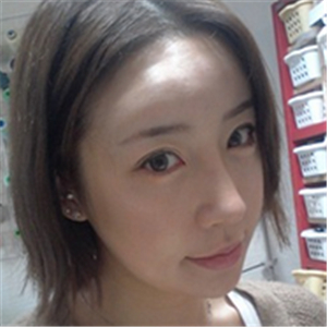 百*麗沈國雄做的隆鼻失敗修復(fù)，恢復(fù)果很好，還有前后對(duì)比照片！