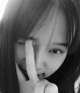 全切雙眼皮+去脂肪，終于擺脫小眼睛了