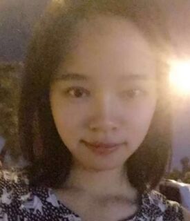 全切雙眼皮+去脂肪，終于擺脫小眼睛了