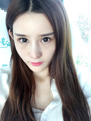 自體脂肪填充全臉后人生像開(kāi)了掛