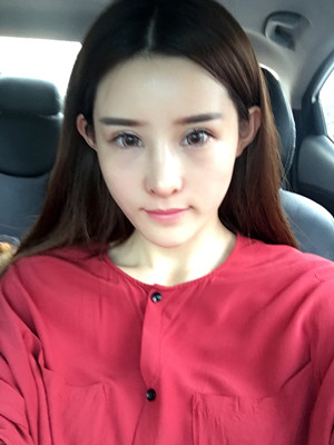 自體脂肪填充全臉后人生像開(kāi)了掛