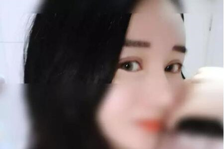 成都天使之翼做的雙眼皮修復(fù)怎么樣 快來(lái)圍觀