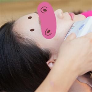 黃慶武醫(yī)生做的音波拉皮除皺手術分享，有很多前后對比果圖片哦~~~