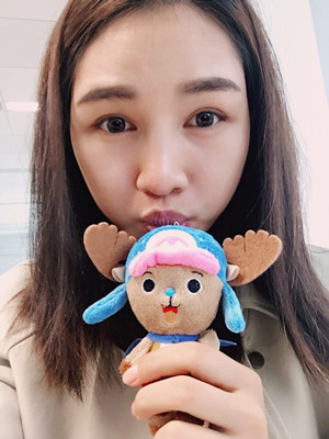 多虧了付俊俐醫(yī)生做的隆鼻整形 臉變立體了