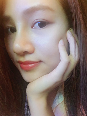 多虧了付俊俐醫(yī)生做的隆鼻整形 臉變立體了