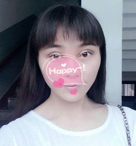 南京康美張讓虎醫(yī)生給我做的眼部綜合整形，大家來看看怎么樣