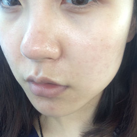 做了黑臉娃娃后，Duang的一下就變成“白雪公主”啦