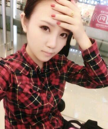 假體隆鼻15天后恢復(fù)果 杭州時光做的~