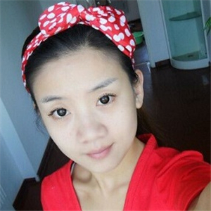 曬曬我做面部吸脂術(shù)前后對比果照片，中日友好高占巍做的哦~~