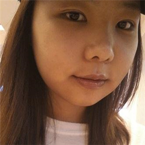 磨下頜角磨骨手術(shù)一個月了，分享一下恢復(fù)前后的果照片哇~