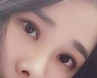 切開雙眼皮價格2680元，費用不貴果卻很好