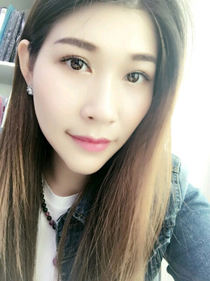 大家來評一下葛紅做的內切去眼袋怎么樣