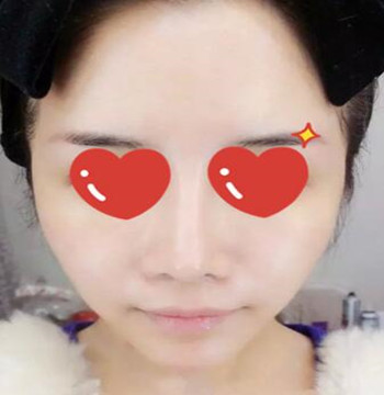 做了拉皮除皺 我的皮膚越來(lái)越緊致光滑了