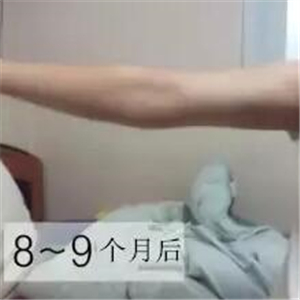 手臂吸脂手術(shù)八個月了，看看我的前后對比果圖片吧~~