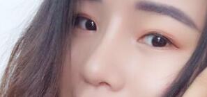 隆鼻圖