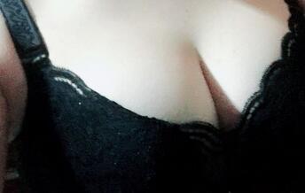 自體脂肪隆胸術后20天恢復圖