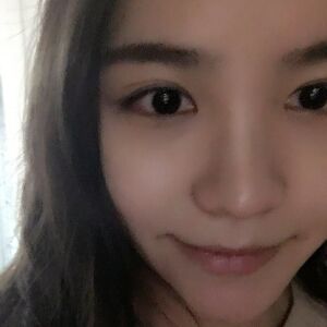 埋埋蛋白線.提升后臉上變得緊致許多，輪廓變得更好看