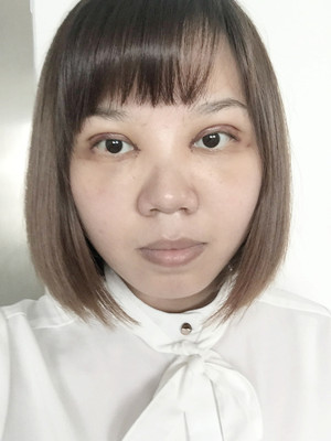 做了雙眼皮多項(xiàng)整形手術(shù)，大家來看看果如何