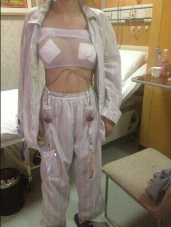 做了假體隆胸手術(shù) 我有了事業(yè)線**