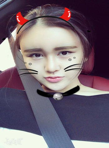 面部自體脂肪填充加隆鼻整形 讓我擁有一張網(wǎng)紅臉