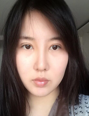 隆鼻整形雙眼皮開眼角讓我從屌絲逆襲成女神