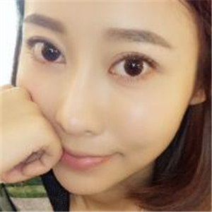 去年做了面部埋埋蛋白線.提升緊致除皺，分享恢復(fù)前后對(duì)比果圖片~